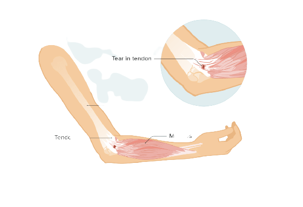 Reduces inflammation in musculoskeletal system